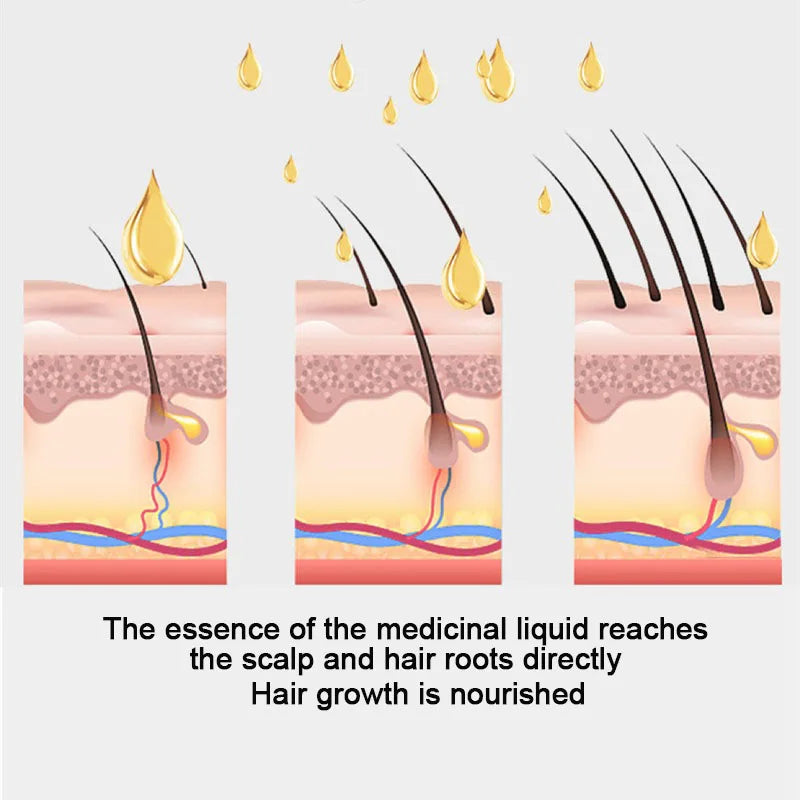 Peigne Applicateur Cuir Chevelu – Masseur Anti-Chute, Guidage Huile Essentielle & Soin Scalp LIXTAIRESHOP